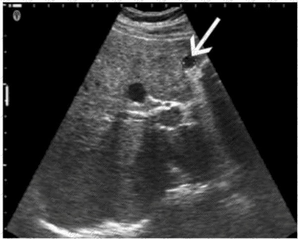 AB-Abdomen Question 28