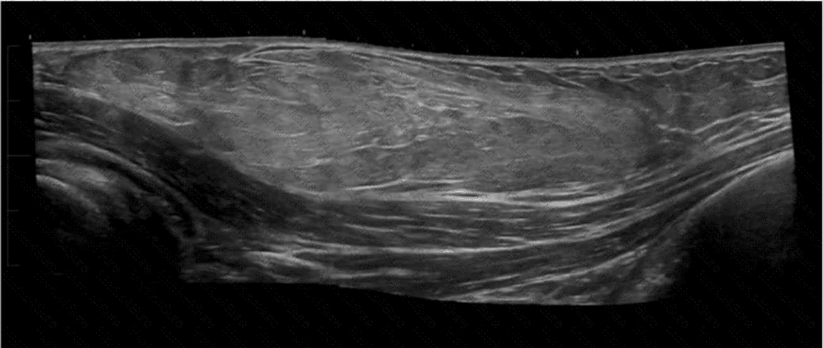 AB-Abdomen Question 40