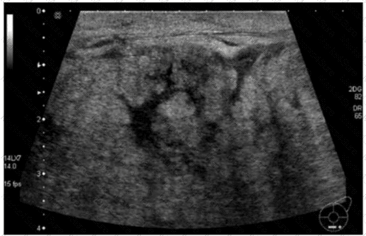 AB-Abdomen Question 34
