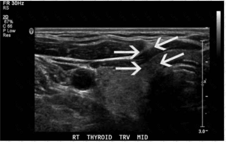 AB-Abdomen Question 23