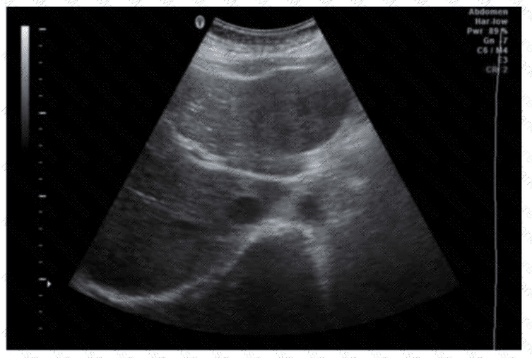 AB-Abdomen Question 26