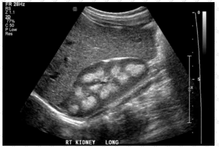 AB-Abdomen Question 9