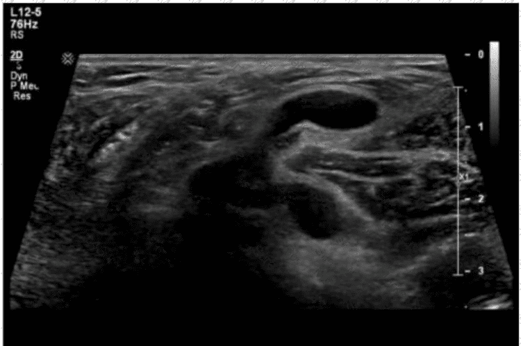 AB-Abdomen Question 39