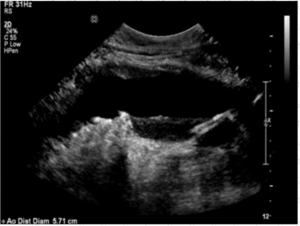 AB-Abdomen Question 6