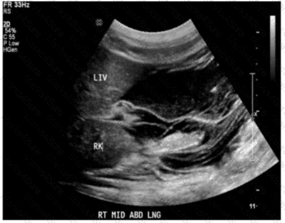 AB-Abdomen Question 16