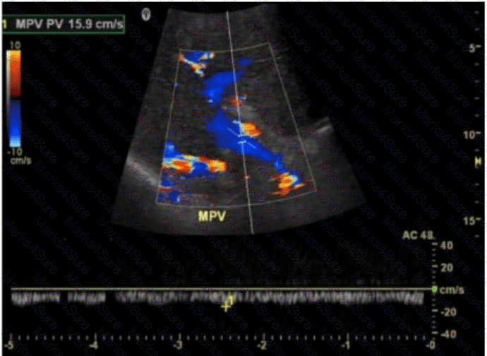 AB-Abdomen Question 42