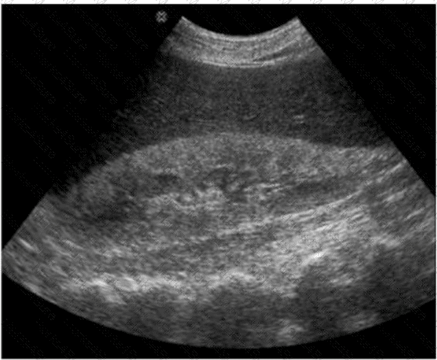 AB-Abdomen Question 29