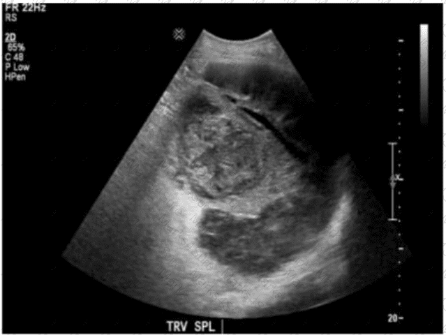 AB-Abdomen Question 45