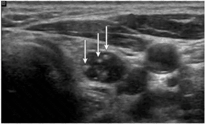 AB-Abdomen Question 21