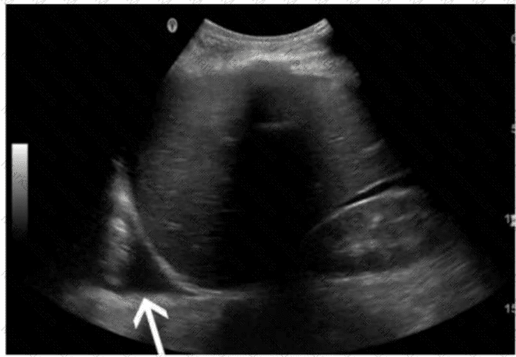 AB-Abdomen Question 14