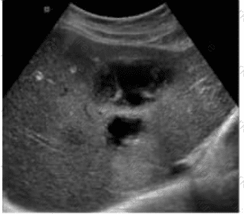 AB-Abdomen Question 30