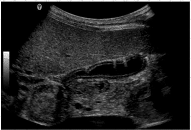AB-Abdomen Question 17