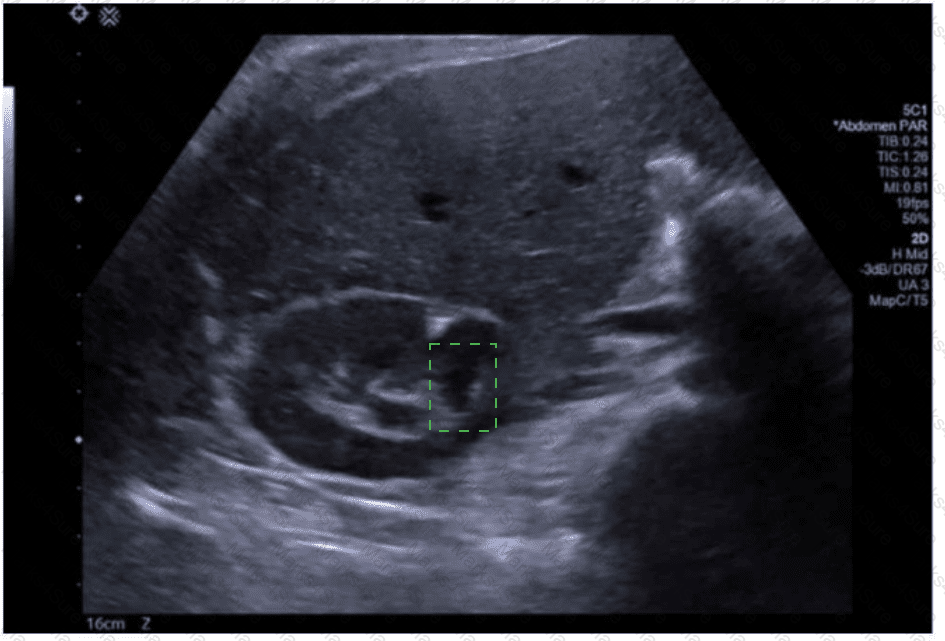 AB-Abdomen Answer 9