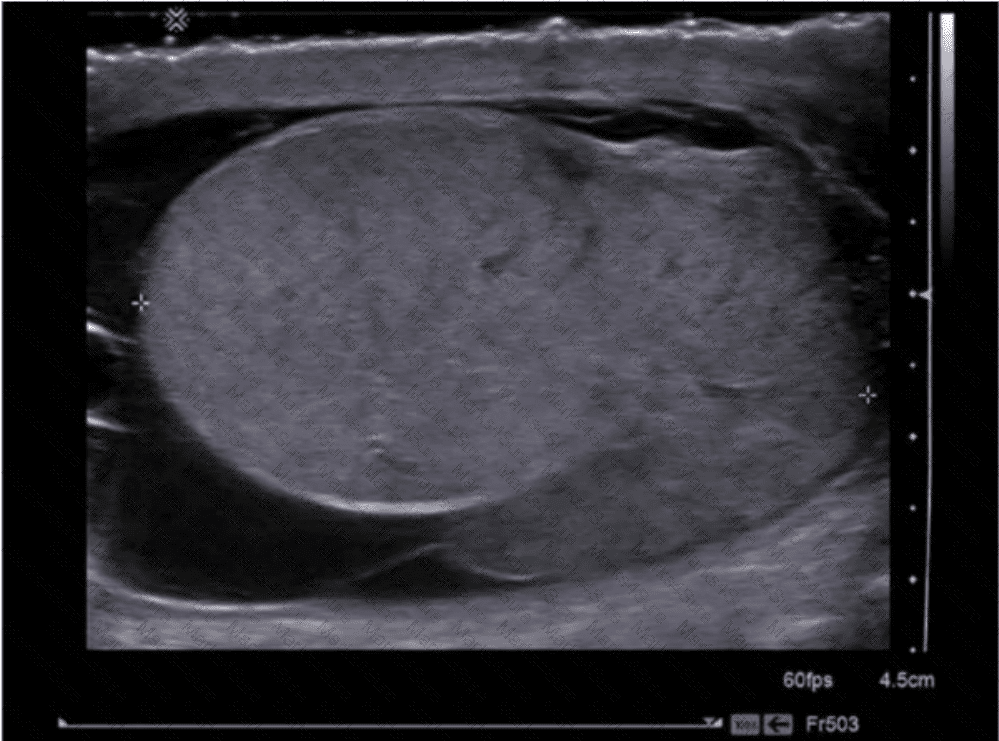 AB-Abdomen Question 30