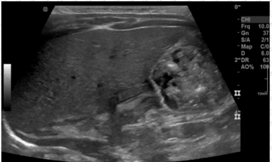 AB-Abdomen Question 36