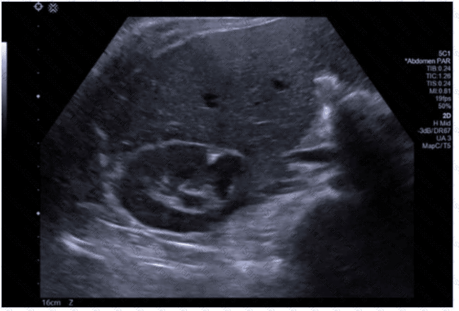 AB-Abdomen Question 9