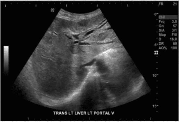 AB-Abdomen Question 37