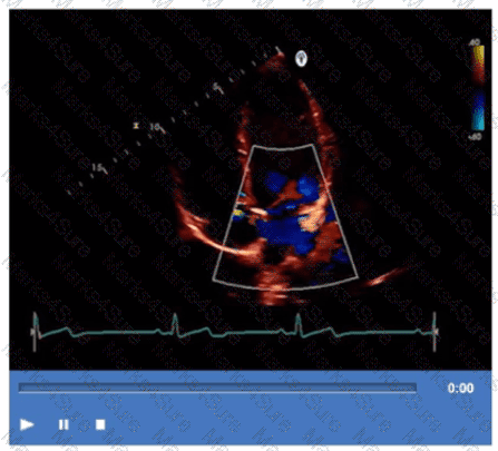 AE-Adult-Echocardiography Question 8