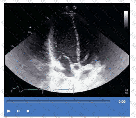 AE-Adult-Echocardiography Question 29