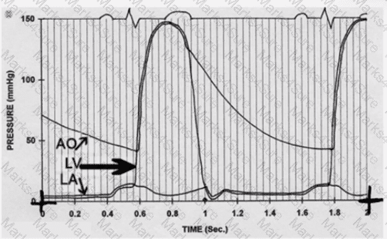 AE-Adult-Echocardiography Question 41