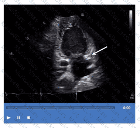 AE-Adult-Echocardiography Question 9