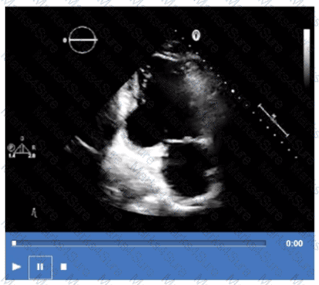 AE-Adult-Echocardiography Question 4