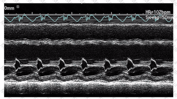 AE-Adult-Echocardiography Question 8