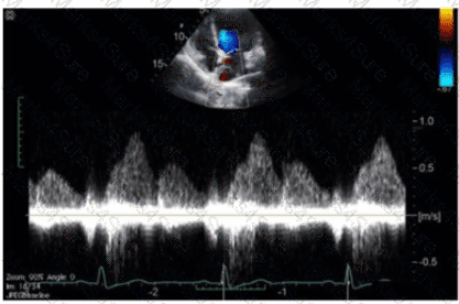 AE-Adult-Echocardiography Question 16