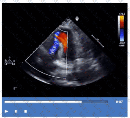 AE-Adult-Echocardiography Question 20