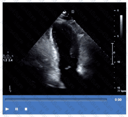 AE-Adult-Echocardiography Question 27