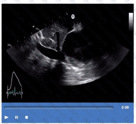AE-Adult-Echocardiography Question 41
