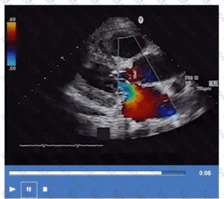 AE-Adult-Echocardiography Question 23