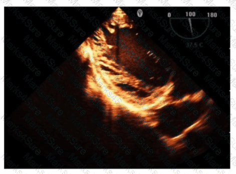 AE-Adult-Echocardiography Question 22