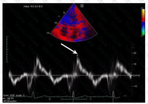 AE-Adult-Echocardiography Question 16