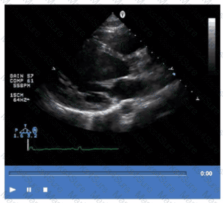 AE-Adult-Echocardiography Question 4