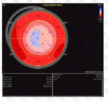 AE-Adult-Echocardiography Question 30