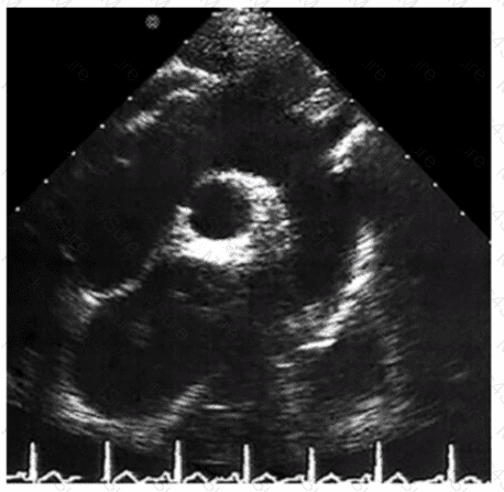 AE-Adult-Echocardiography Question 39