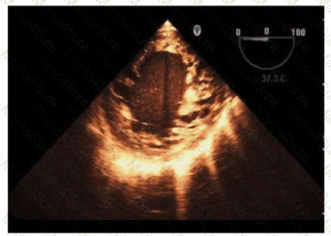 AE-Adult-Echocardiography Question 22