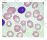 ASCP-MLT Question 80