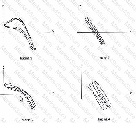RPFT Question 31