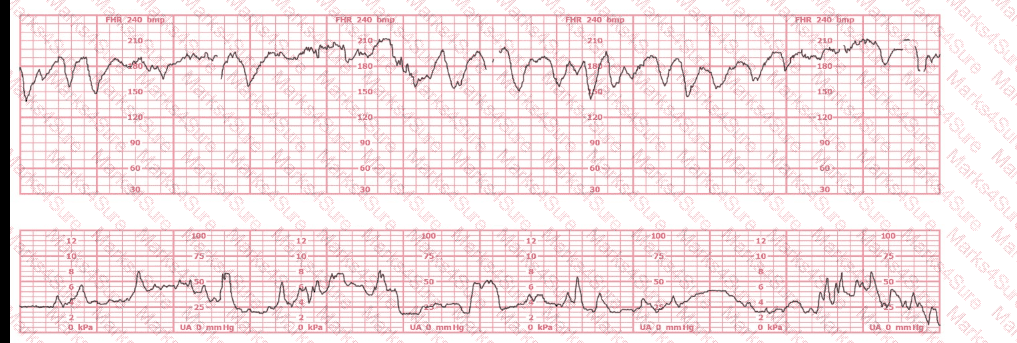 EFM Question 22